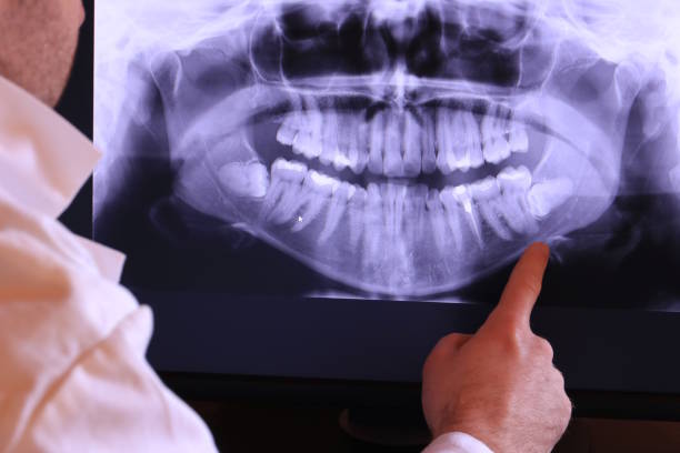 Best Emergency Dentist for Knocked-Out Tooth in Dunlap, IL