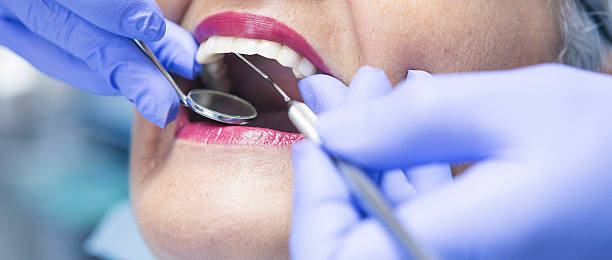 Best Emergency Dental Extractions in Dunlap, IL